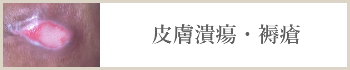 皮膚潰瘍・褥瘡