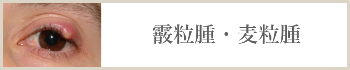 霰粒腫・麦粒腫