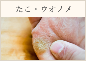 たこ・ウオノメ