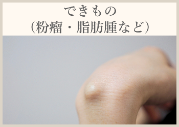 できもの(粉瘤・脂肪腫など)