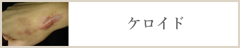 ケロイド