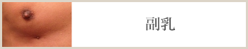 副乳