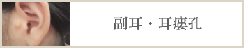 副耳・耳瘻孔