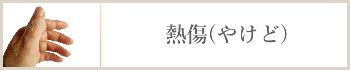 熱傷(やけど)