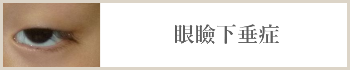 眼瞼下垂症