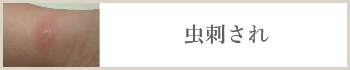 虫刺され