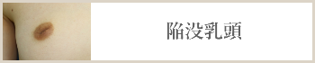 陥没乳頭
