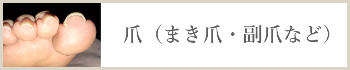 爪（まき爪・副爪など）
