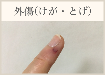 外傷(けが・とげ)