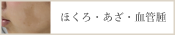 ほくろ・あざ・血管腫