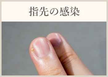 指先の感染